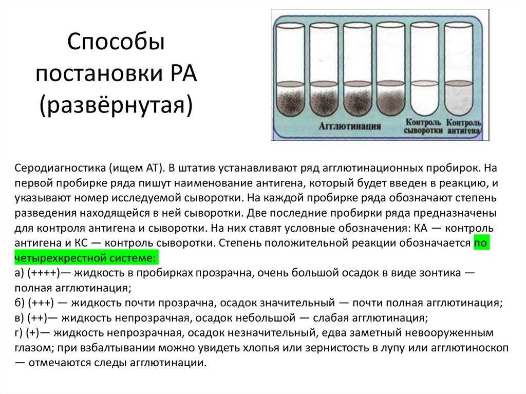 Способ получения латексного диагностикума для постановки реакции латекс-агглютинации — 15.09.2011 —  24631 — база патентов казахстана