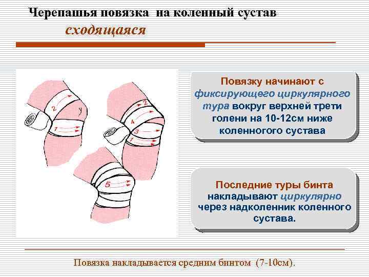 Как черепашья повязка применяется при травмах: виды, техника исполнения, правила наложения
