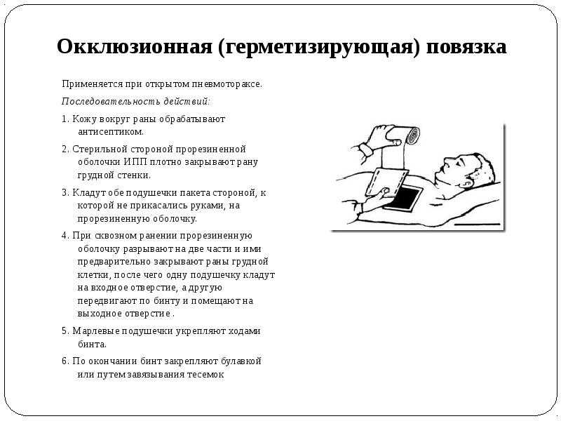 Повязка при пневмотораксе: материалы, техника наложения | s-voi.ru