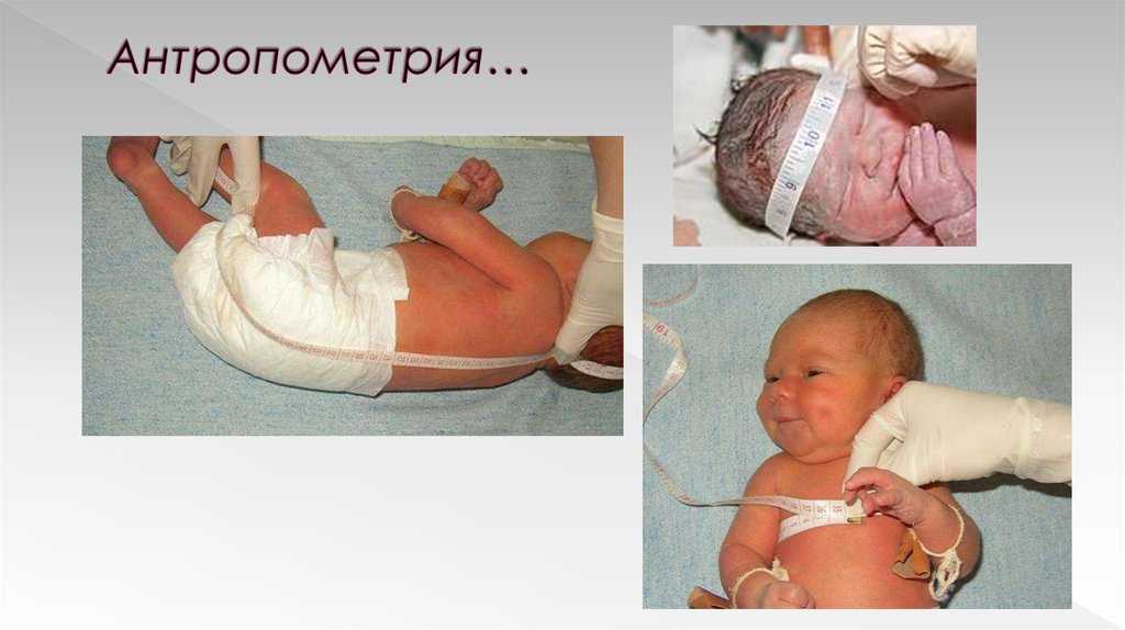 Техника измерения длины тела детям до года и старше
