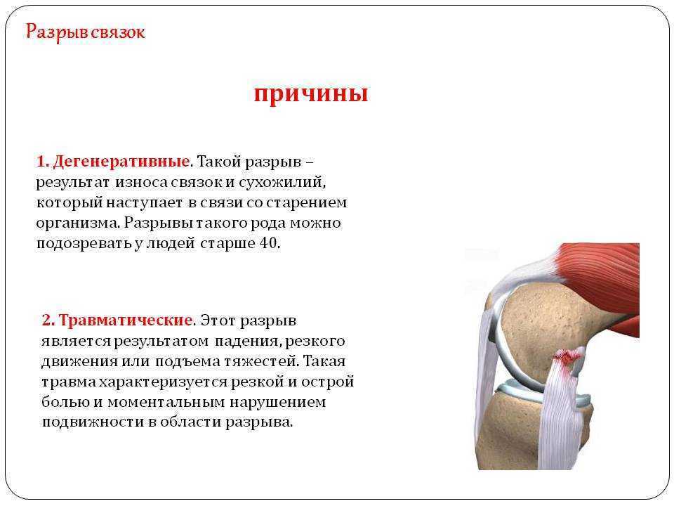 Прочность и живучесть ружейных стволов. статьи об оружии внутренняя баллистика