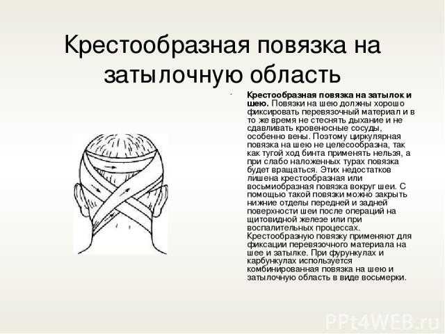 Какая повязка накладывается при повреждении затылка: крестообразная, пращевидная, восьмиобразная