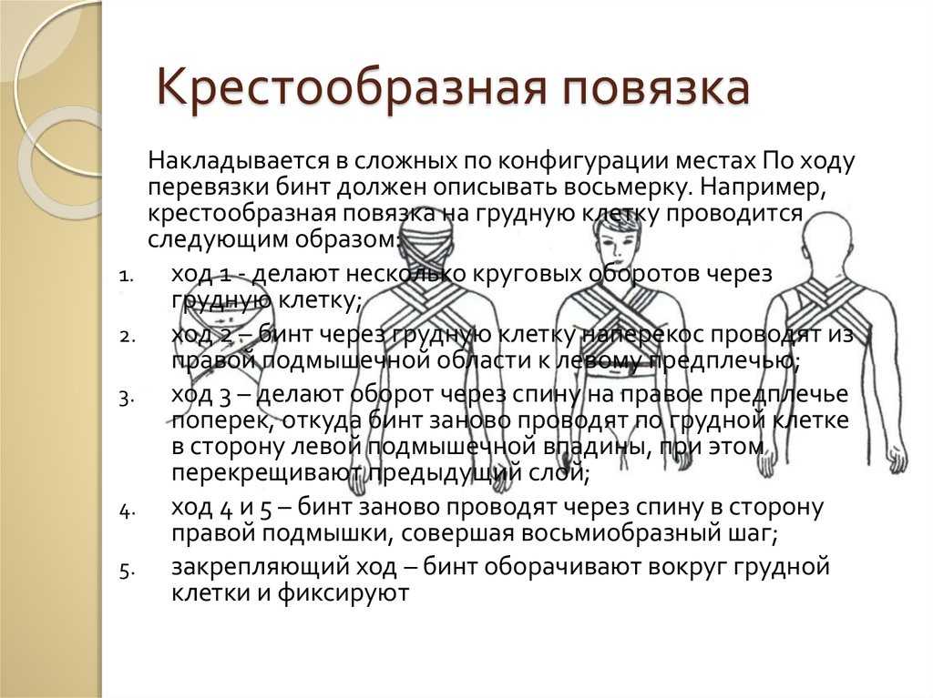 Техника наложения бинтовой повязки на молочную железу. наложение повязки на молочную железу алгоритм накладывание повязки при помощи бинта
