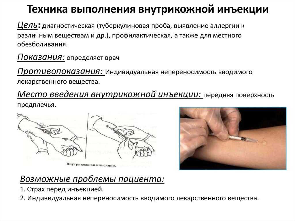 Манипуляция внутримышечное введение лекарственного препарата