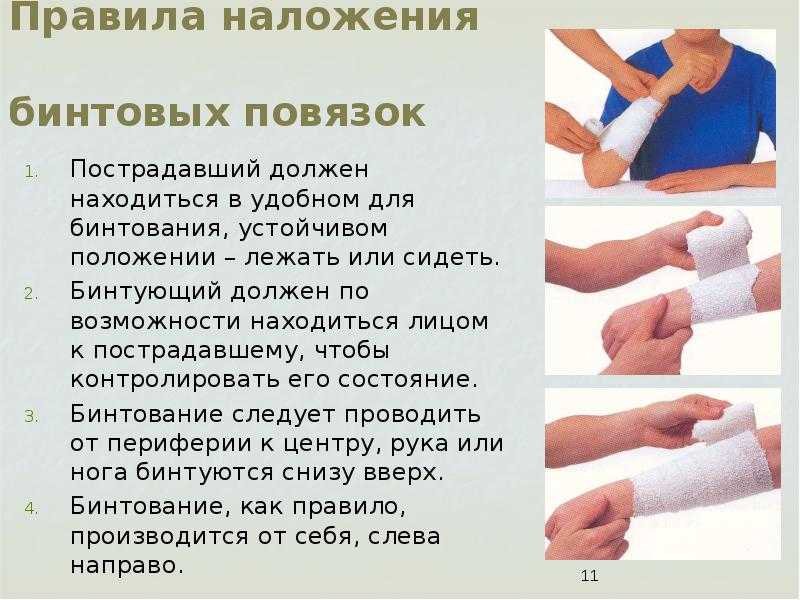 Как осуществить наложение повязок на раны?