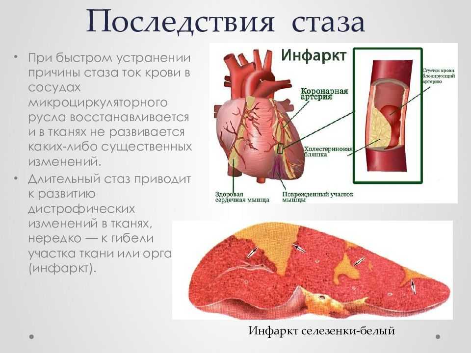 Стаз [1965 альперн д.е. - патологическая физиология]