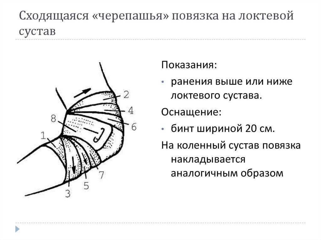 Черепашья повязка на травмированный коленный сустав: описание и характеристика, инструкция по наложению
