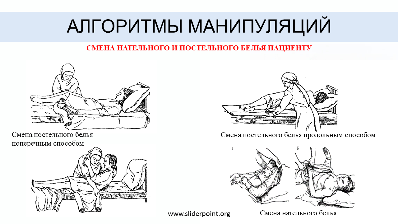Смена постельного белья тяжелобольному: алгоритм того, как проводится манипуляция продольным способом для пациента и правила этого
