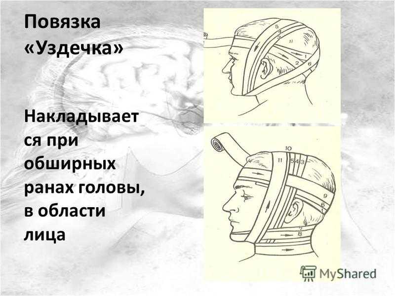 Виды медицинских повязок на голову