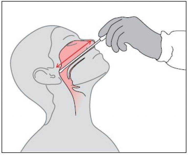 Мазок из зева как брать
