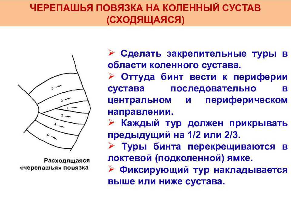 Черепашья повязка: виды и способы применения