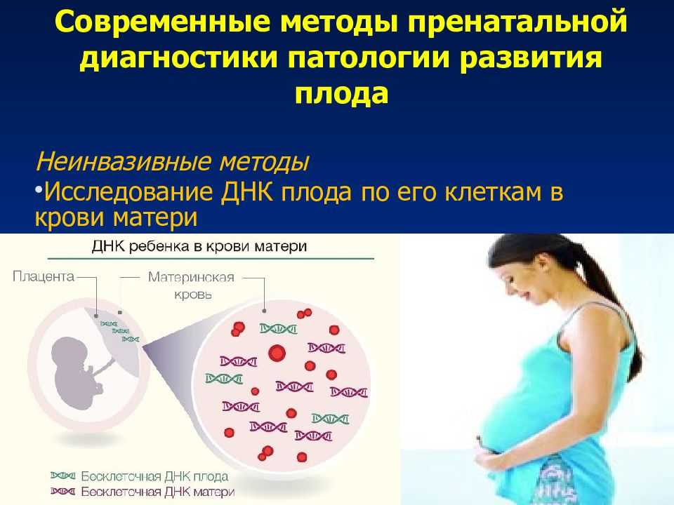 Анеуплоидия - med24info.com