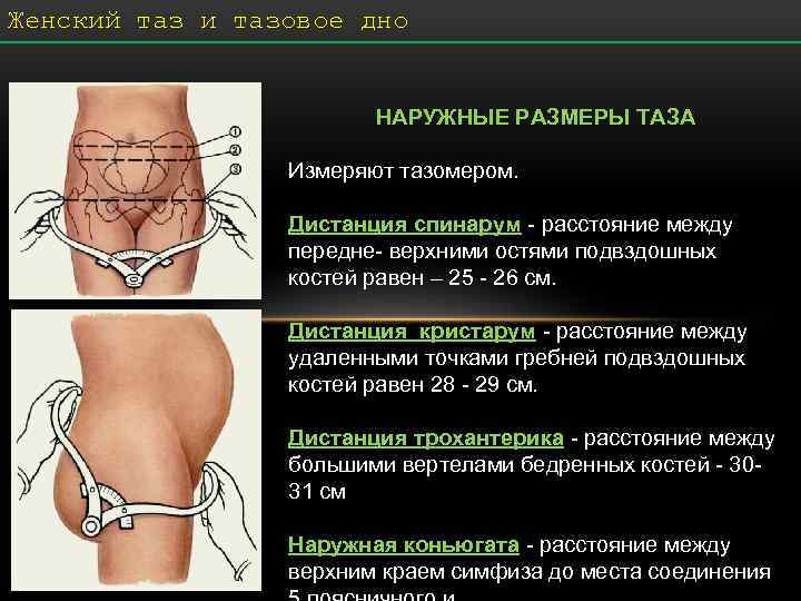 Исследование таза беременной. крестцовый ромб ( ромб михаэлиса ).
