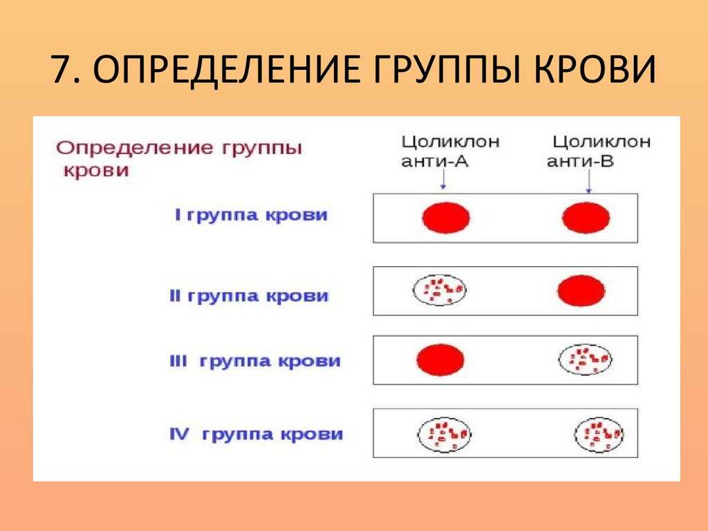 Приготовление оснащения для определения группы крови алгоритм