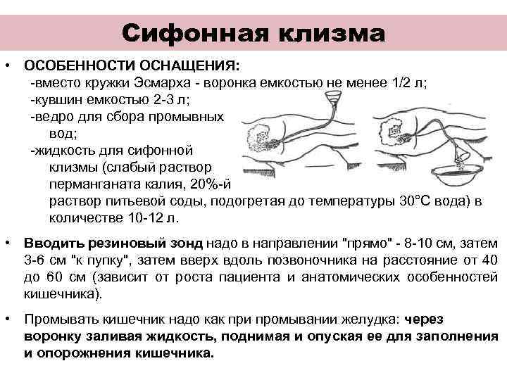 Техника проведения сифонной клизмы