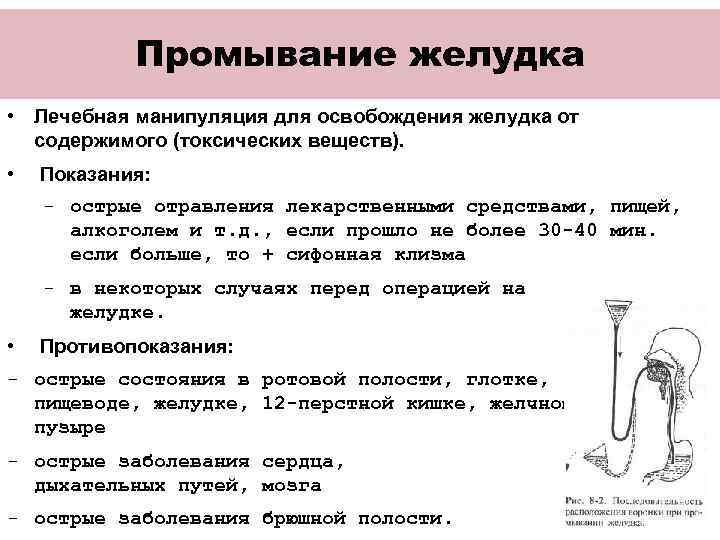 Манипуляция № 122 «техника промывания желудка»
