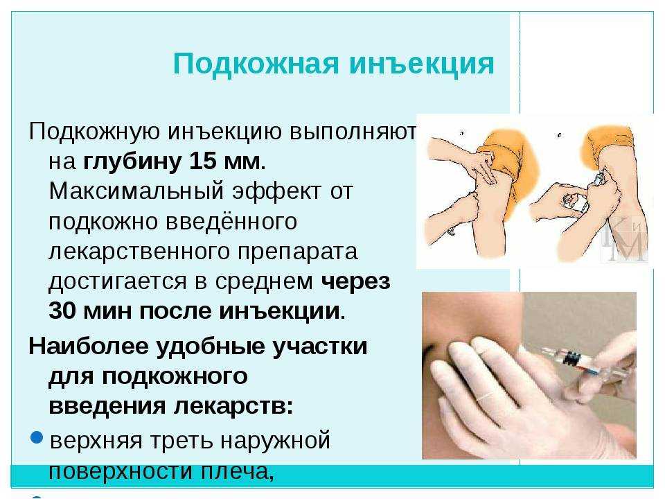 Как выполняется внутримышечная инъекция