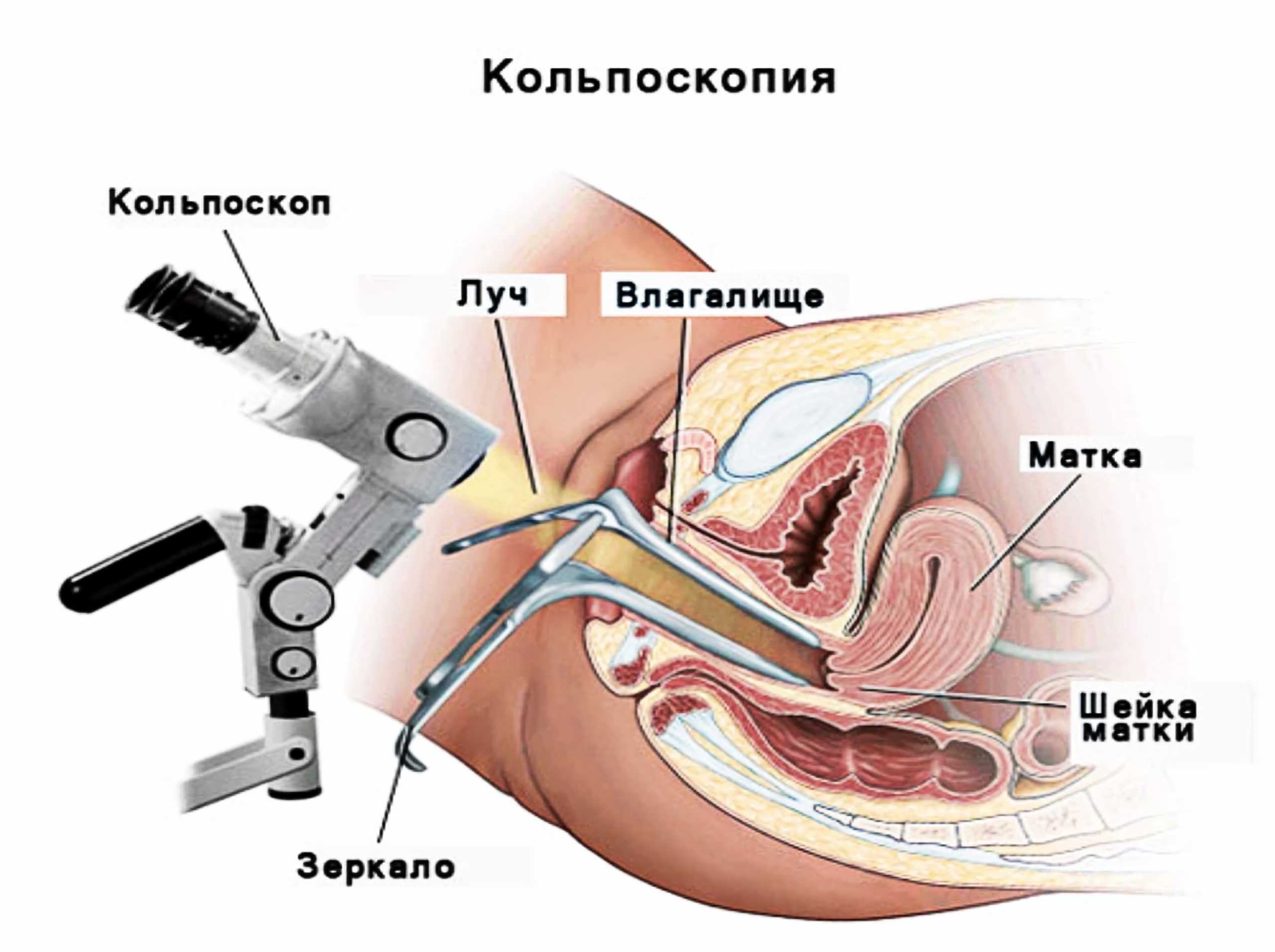 Учебное пособие: основы гинекологического исследования и акушерства. как врачи используют гинекологическое зеркало самообследование гинекологическим зеркалом