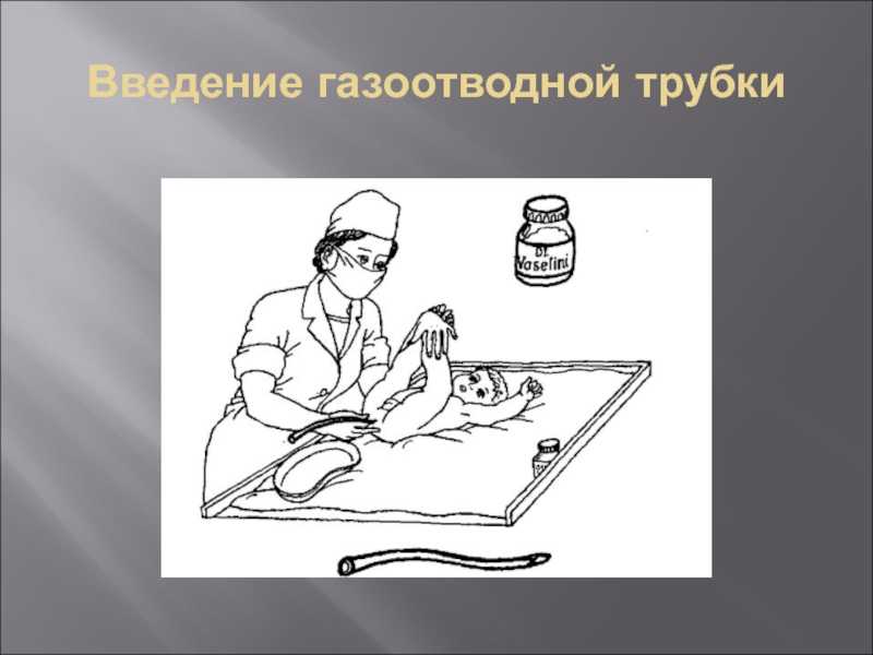 Газоотводная трубка для новорожденных: инструкция по пользованию