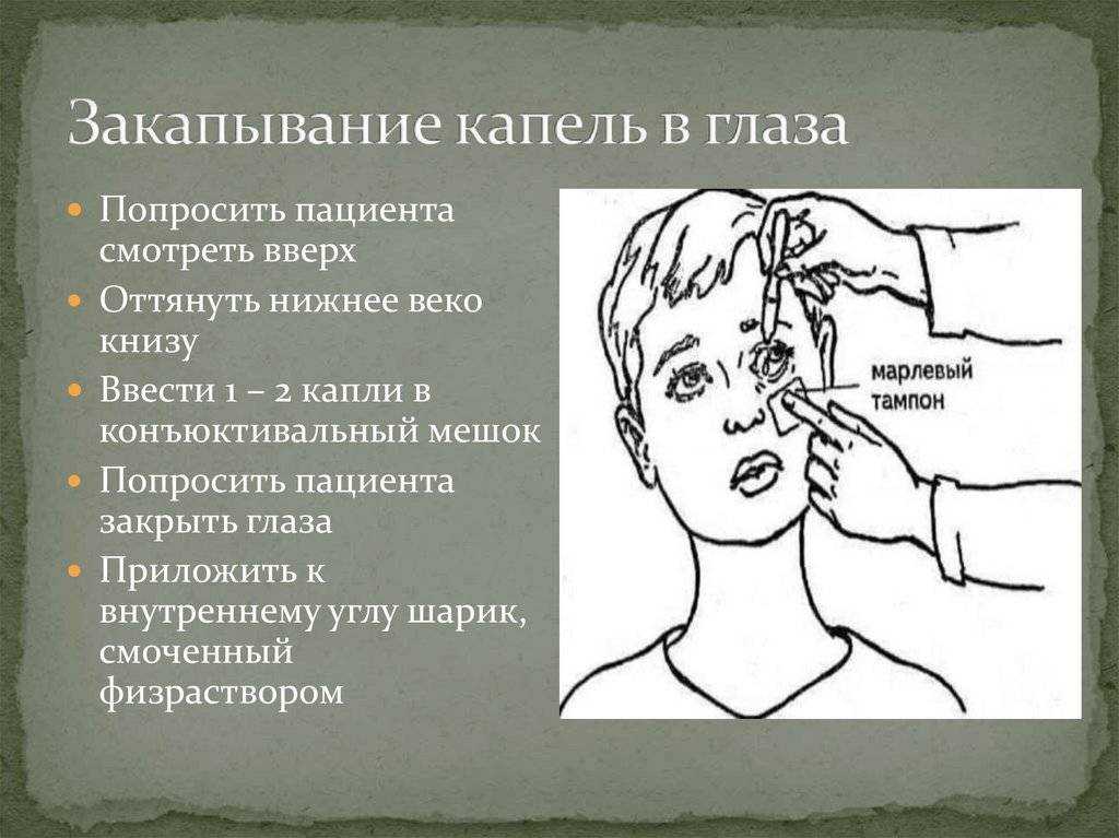 Процесс закапывания капель в глазки грудничку: что делать, если малыш жмурится