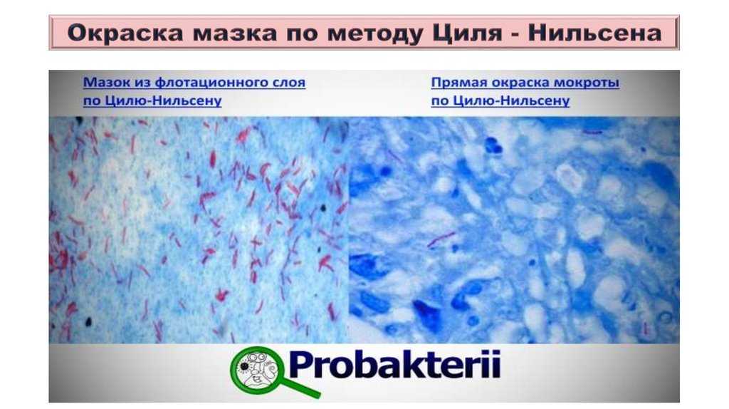 Окраска по ожешко микробиология кратко