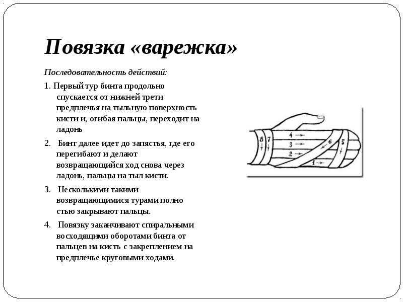 Повязка варежка: показания, виды, техника и алгоритм наложения повязки варежки