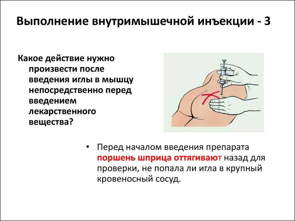 Манипуляция внутримышечное введение лекарственного препарата