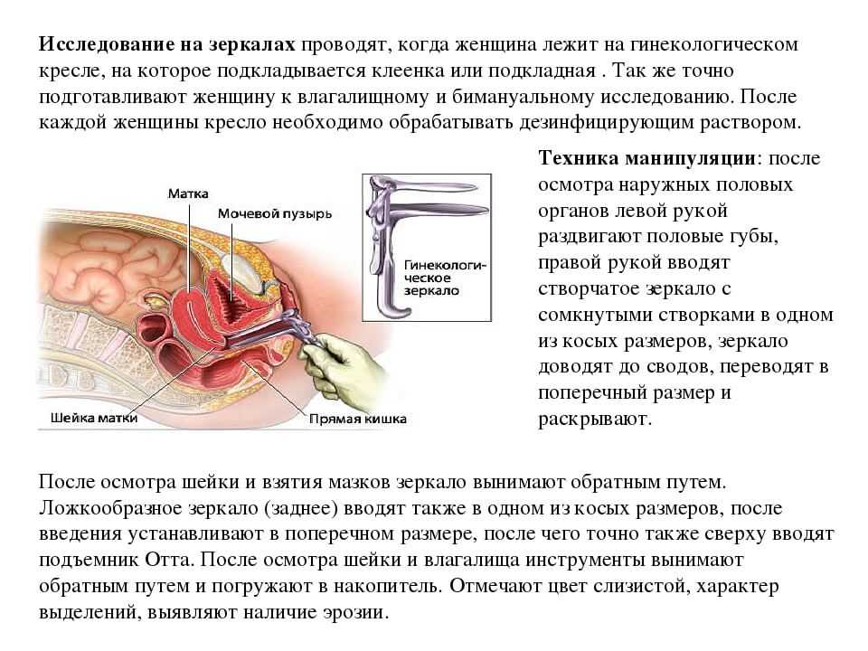 Боль при осмотре зеркалом у гинеколога