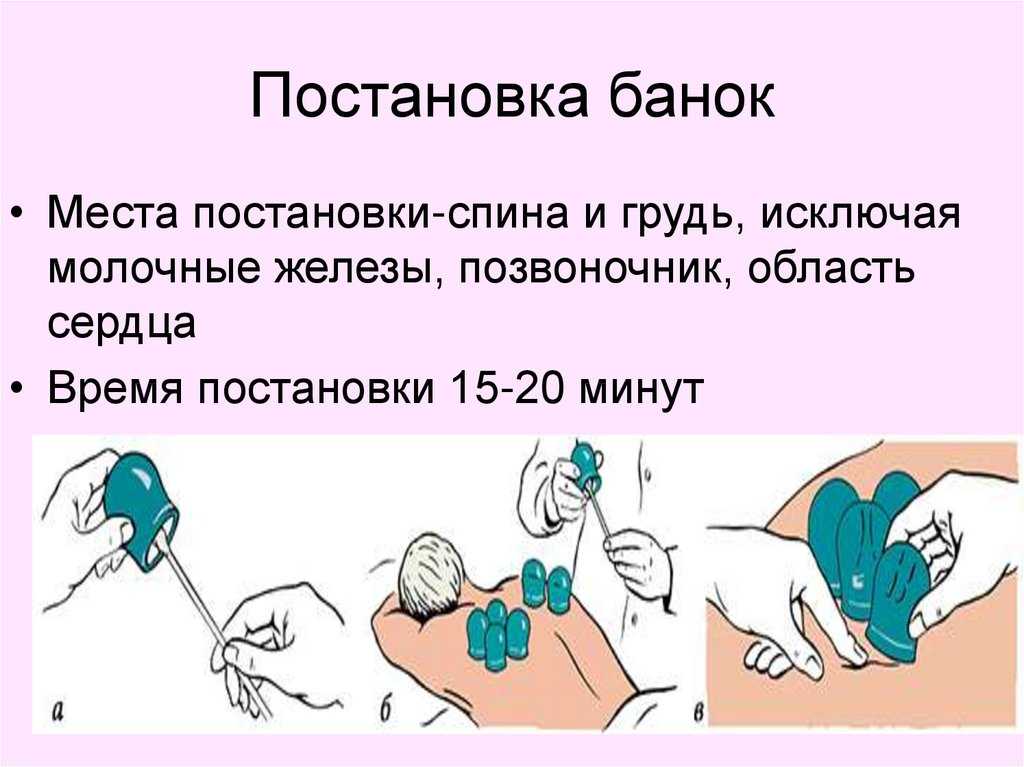 Техника постановки горчичников детям и горчичное обертывание