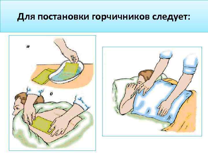 Постановка горчичников