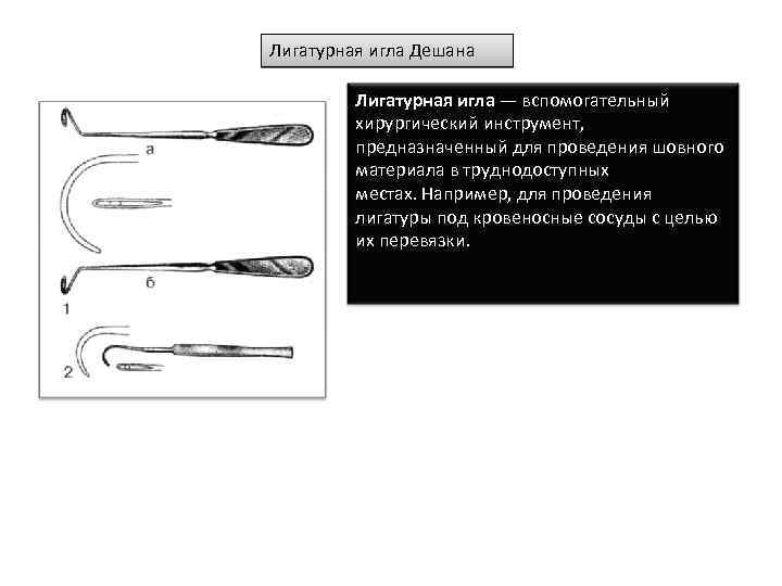 Иглы медицинские — большая медицинская энциклопедия