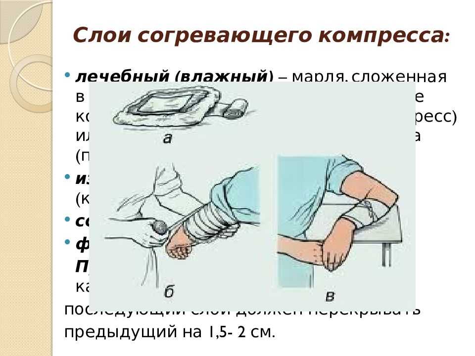 Алгоритм постановки согревающего компресса, показания к применению