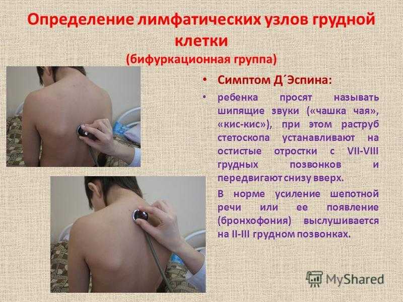 Внутрилегочные лимфоузлы на кт - бронхопульмональные лимфоузлы на кт