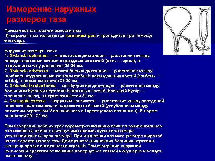 Исследование таза беременной. крестцовый ромб ( ромб михаэлиса ).