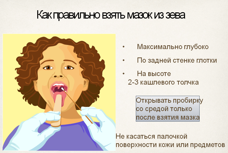 Мазок из зева как брать