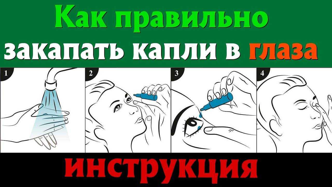 Закапывание капель в глаза детям и взрослым, алгоритм и техника