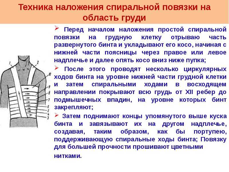 Наложение повязки на молочную железу алгоритм - гинеколог