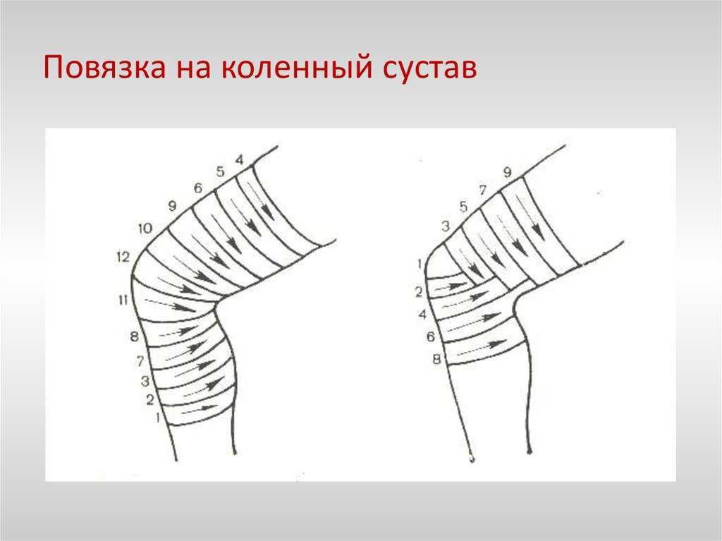 Повязка на нижние конечности