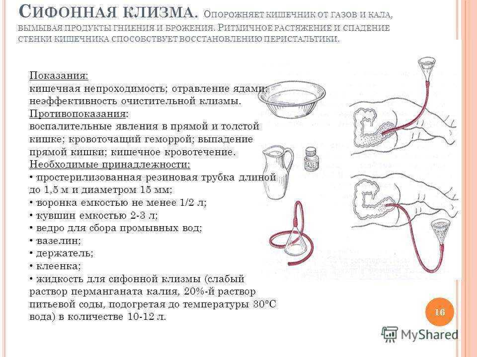 Клизма сифонная: показания, техника и правила постановки, алгоритм выполнения очищения кишечника и возможные осложнения, противопоказания
