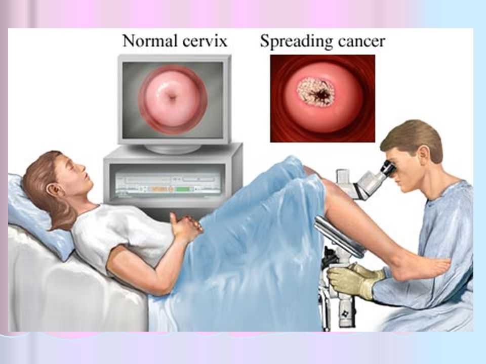 Презентация на тему "осмотр наружных половых органов, влагалища и шейки матки при помощи зеркал"