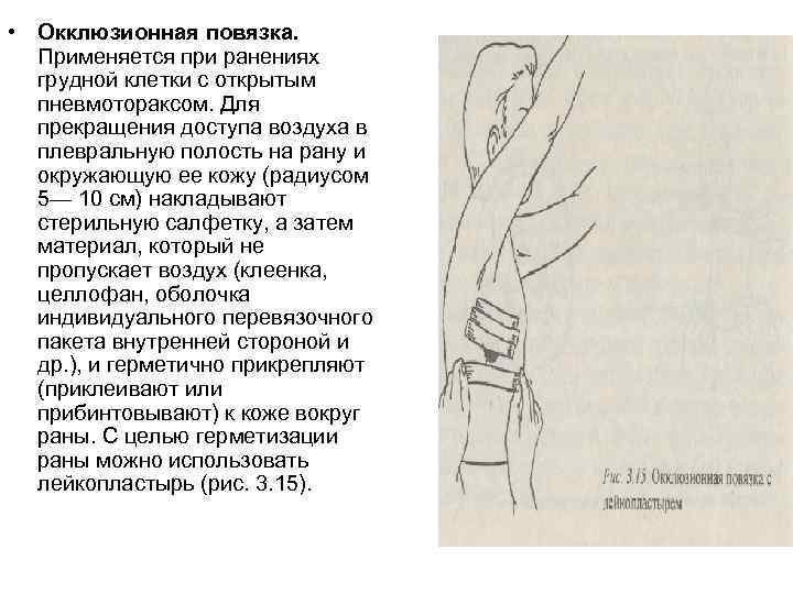 Окклюзионная повязка - что это такое? техника наложения при открытом пневмотораксе