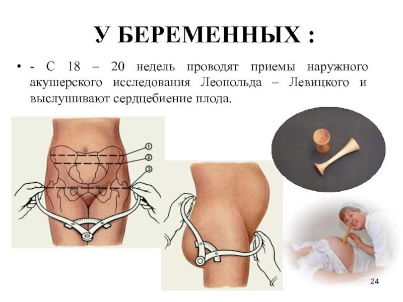 Приемы леопольда левицкого кратко