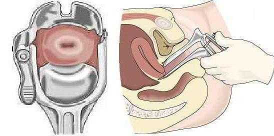 Акушерско-гинекологический инструментарий — большая медицинская энциклопедия