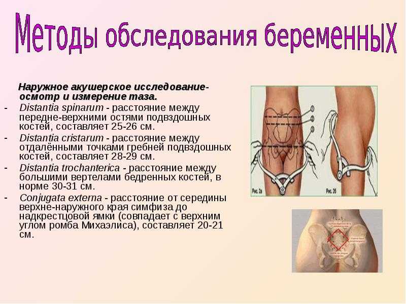 Исследование таза беременной. крестцовый ромб ( ромб михаэлиса ).