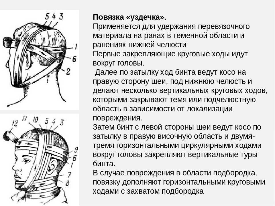 Виды медицинских повязок на голову
