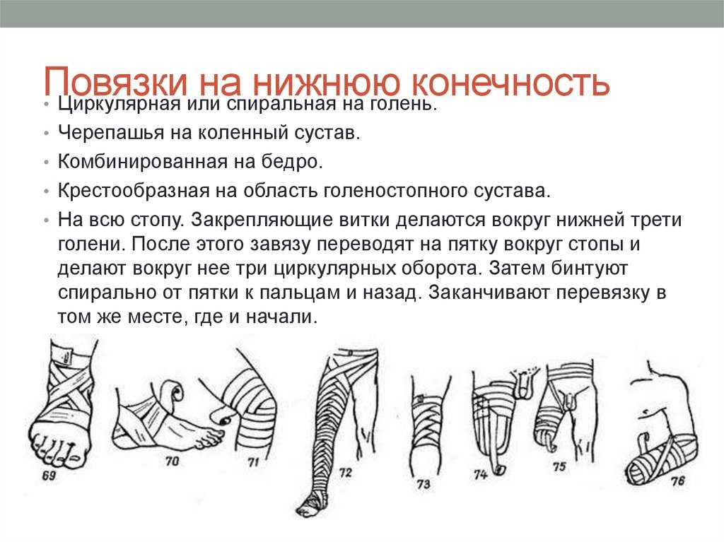 Культя после ампутации ноги - правила ухода +7(800)222-70-43