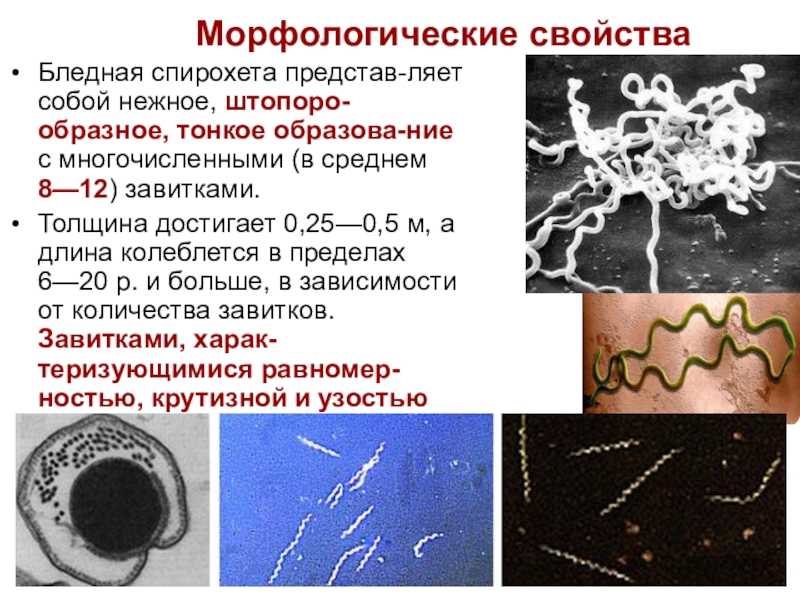 Спирохеты: классификация патогенных бактерий