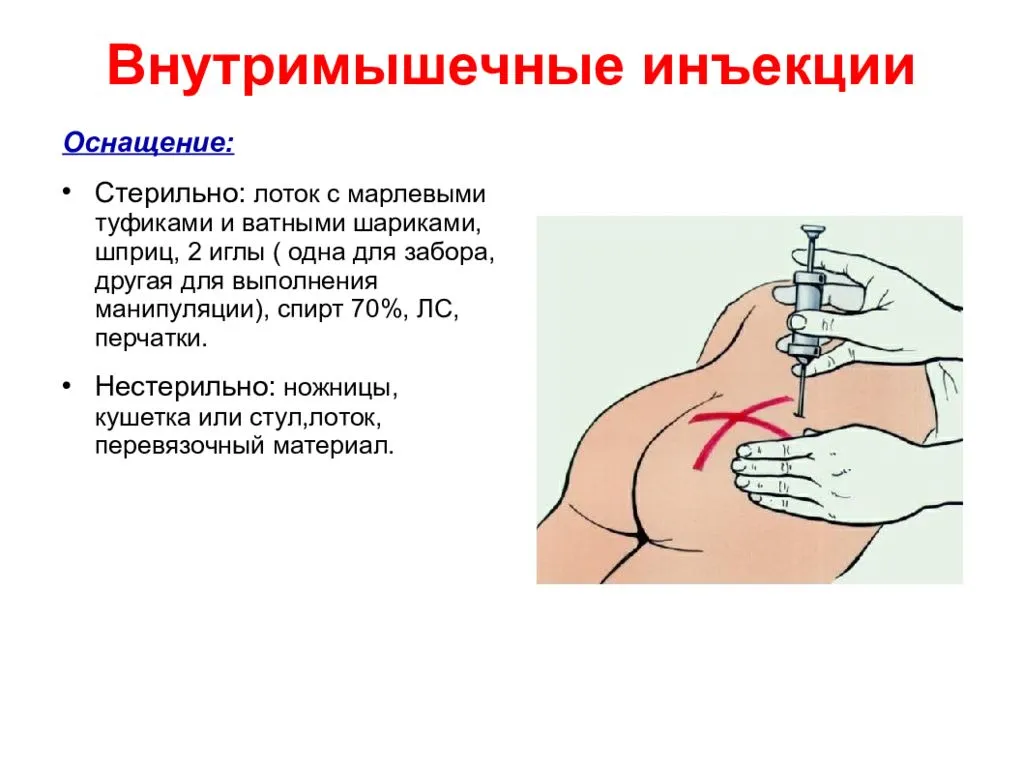 Внутримышечное введение лекарственного средства алгоритм