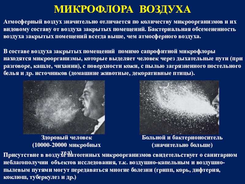 Исследование микрофлоры воздуха в помещении