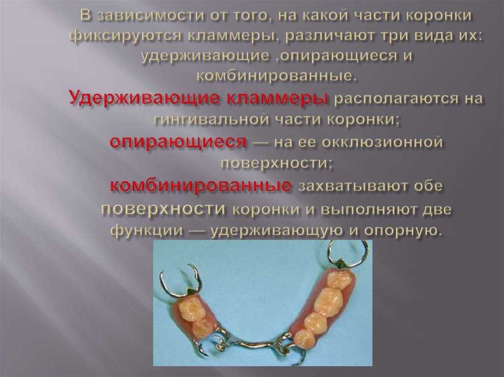 Кламмеры системы нея, их особенности и использование